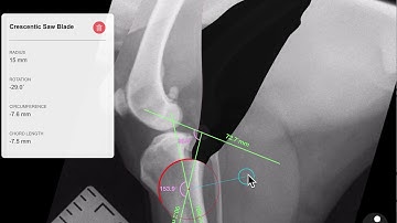 How to plan a CBLO in vPOP-pro!