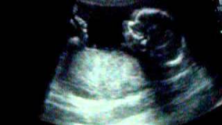 bébé Gingras-Bélisle en images, 18 5/7 semaines