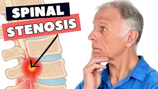 8 Fixes That Can Greatly Help Lumbar Spinal Stenosis