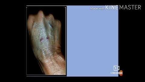 STD - 6 SUB : SCIENCE LS.NO 4 DISASTER MANAGEMENT Part 2