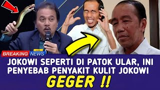 JOKOWI SEPERTI DI PATOK ULAR !! INI PENYEBAB PENYAKIT KULIT PAK JOKOWI YANG JARANG ORANG KETAHUI