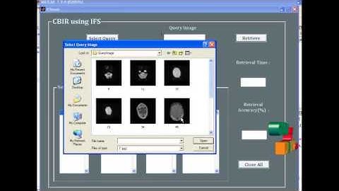 Final Year Projects | Texture Retrieval System using Intuitionistic Fuzzy Set Theory
