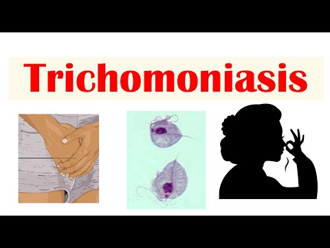 Video: Siz trichomoniasis diaqnozunu səhv qoya bilərsinizmi?