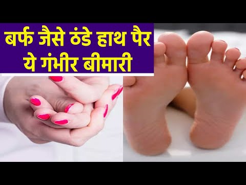 वीडियो: ठंडे पैरों का इलाज कैसे करें: 14 कदम (चित्रों के साथ)