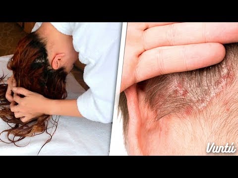 Video: ¿Qué humedad es mala para el cabello?