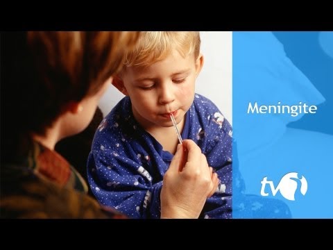 Vídeo: Meningite - Meningite Em Crianças