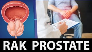 Rak prostate Dr#51