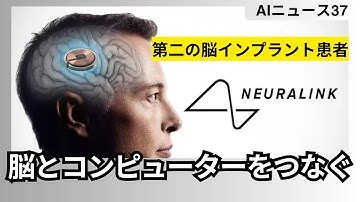 イーロンマスクの野望Neuralinkで実現する脳と機械の融合:第二の患者