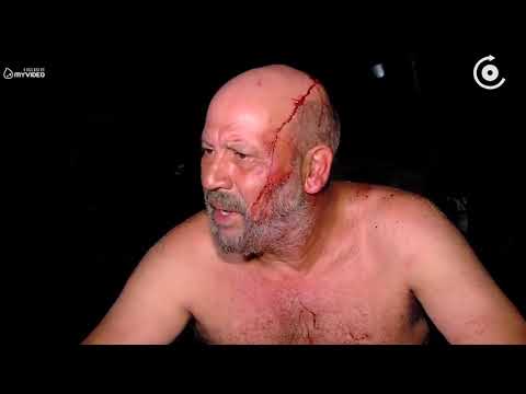 ნაჯახით, ურო და ჩაქუჩებით შეიარაღებულმა ყაჩაღებმა ბიზნესმენი და მისი ცოლი სასტიკად სცემეს   თავდამსხ