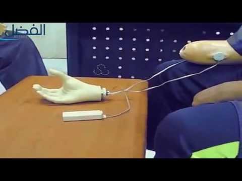 Videos of upper limb prostheses 7