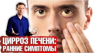 Цирроз печени: первые симптомы ► Как распознать цирроз печени на ранних стадиях? 🔴