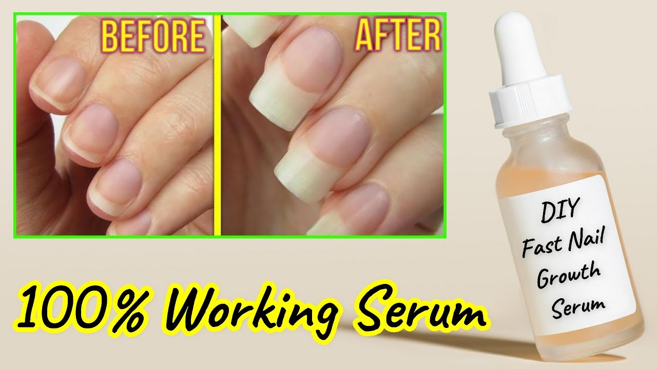 The Best Nail Serum for Damaged Nails and Cuticles — Reviews | Allure