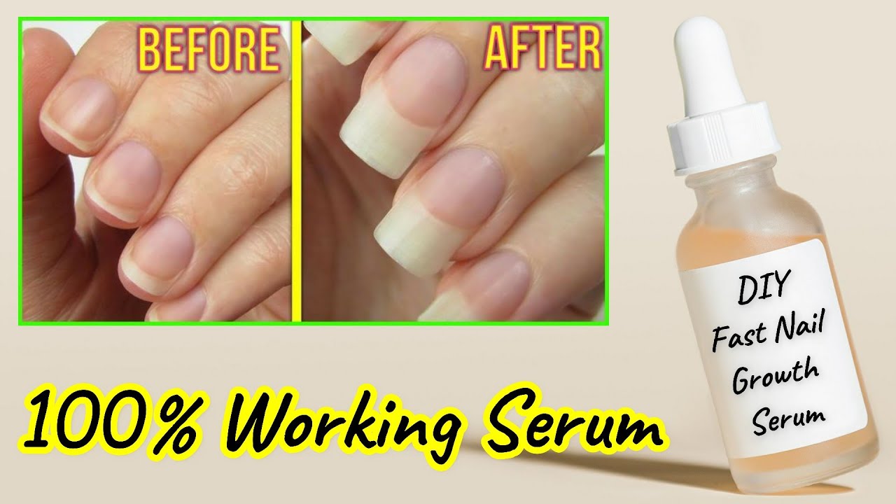 Best nail growth treatments 2022 - how to strengthen and lengthen nails