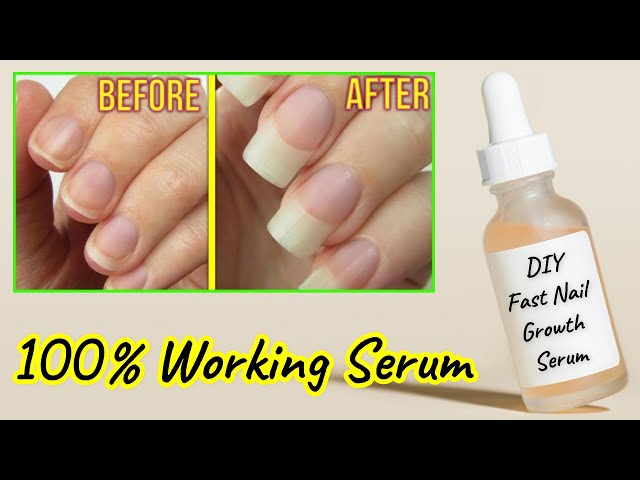 Nail Serum For Nail Growth Repair, Nail Cuticle Remover, Nail Growth Serum  at Rs 1490/piece | Nail Cream in Haridwar | ID: 2852624251812