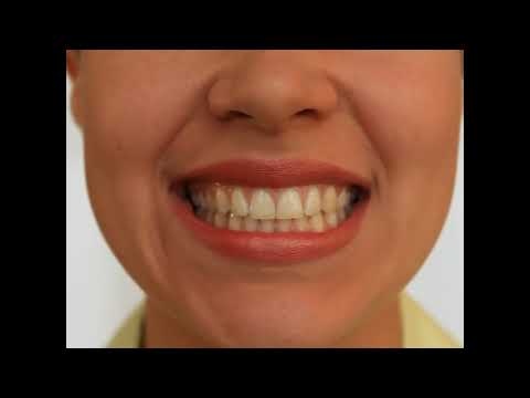 Артикуляционная гимнастика 