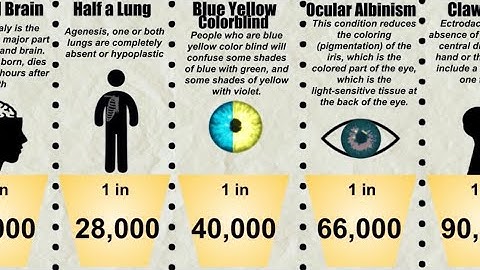 Probability Comparison: Rarest Human Traits