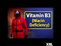 Vitamin B3 ( Niacin Deficiency ) #davidson