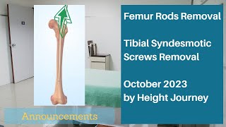 My Upcoming Femur Rod Removal Surgery - October 2023