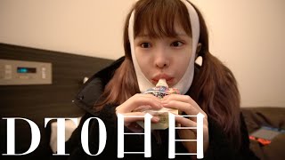 顎の骨切りとりま生存報告☆ストイックに当日編集☆