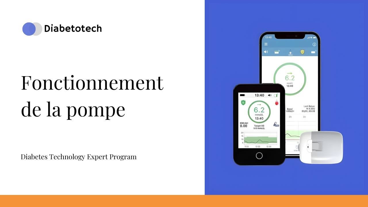 Инсулиновая помпа Medtrum Nano | Как работает помпа | Diabetotech