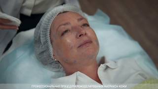 G-DERM | Безынъекционная биоревитализация