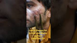 Dr.Salman# Best leech therapy centre#kubra Hijama. screenshot 2