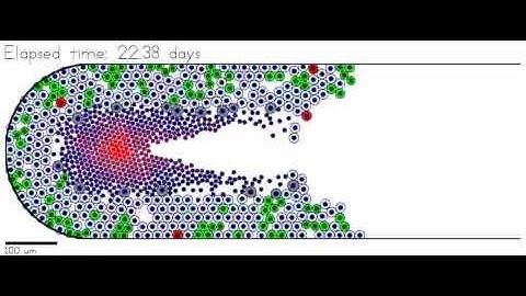 Ductal carcinoma in situ (DCIS) simulation