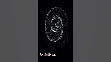 Try Not to Get Hypnotized by This Spiral 🌀 #shorts #techno #opticalillusion