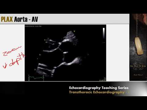 Lecture 3 Transthoracic Echocardiography Part 2 