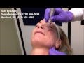 Eclipse micropen elite demonstration   brittany white fnp msn   skin by lovely