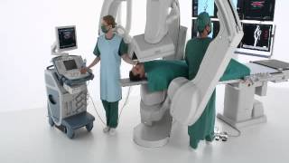 Dr Baker - Infinix-i 5-Axis Clinical Advantages