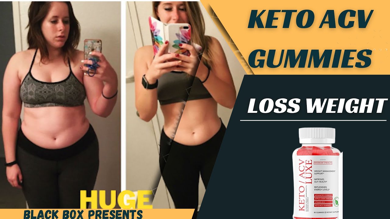 Vist Keto Gummies:What You Need To Know