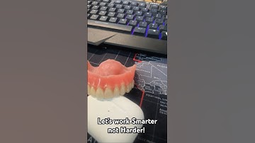 3D printed Denture & porcelain Denture teeth looks amazing ! #dentalkronicles #3dprintingmaterials