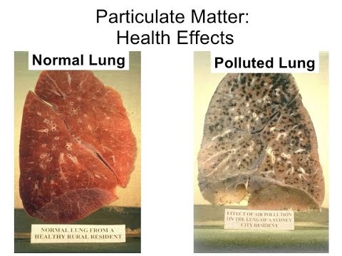 Image result for polluted lungs vs healthy lungs