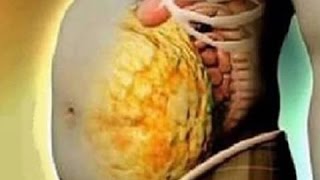 7 Signos De Que Tienes Demasiadas Toxinas En El Cuerpo Y C�mo Ayudar A Eliminarlas | Mejor Salud