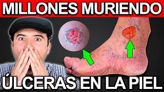 HOW TO HEAL SKIN ULCERS THAT WON'T GET BETTER | 5 Steps to Regenerate Varicose Ulcers screenshot 1
