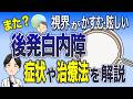 【後発白内障とは？】白内障手術したのにまた白内障になる？眼科専門医が解説！