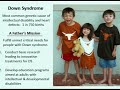 Which Genes Cause Problems in Down Syndrome? Jon Pierce, PhD