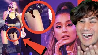 Singers Most Embarrassing Moments On Stage Part 3
