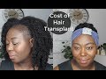 Q&A How Much does a Hair Transplant Cost