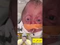 اللهم اعفي عنه