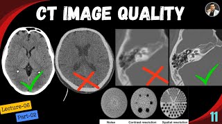CT Image quality-Lecture 06 (Part-02)-Tutorial-11 | Spatial Resolution | Contrast Resolution | Noise