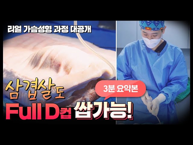 가슴성형 과정 3분 만에 직접 보여dream~!(feat. 삼겹살)