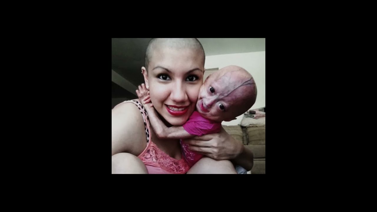 I M Late To Post This RIP Adalia Rose 12 01 22 TeamKenMembers