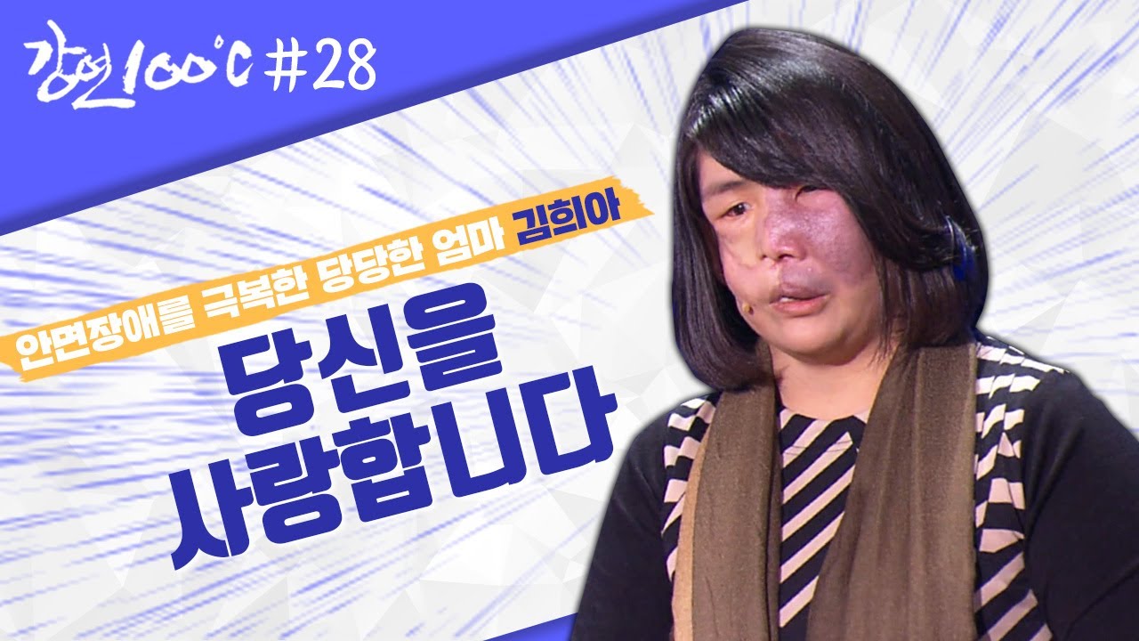 안면 장애를 극복한 당당한 엄마 김희아⭐[강연 100℃] l KBS 130104 방송