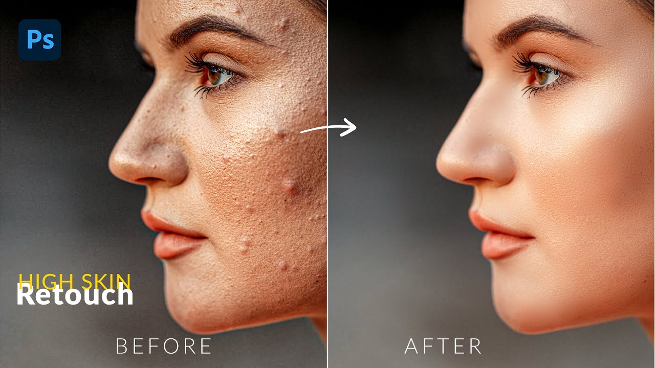 High-End Skin Retouch in Photoshop | Photoshop Tutorial