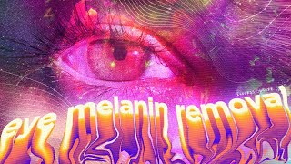 quick & safe EYE MELANIN REMOVAL (subliminal)