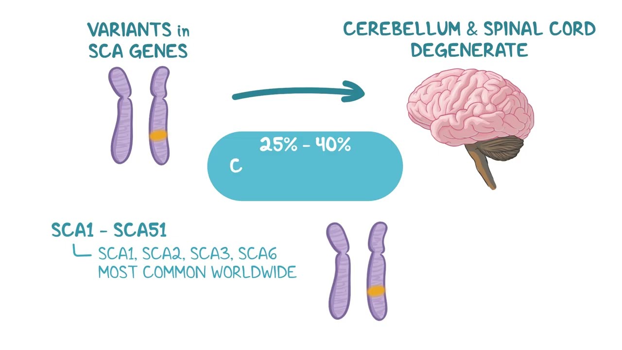 How Is Spinocerebellar Ataxia Diagnosed