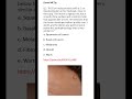 Medicine & Surgery MCQs (For MBBS, USMLE, MCCQE & PLAB)