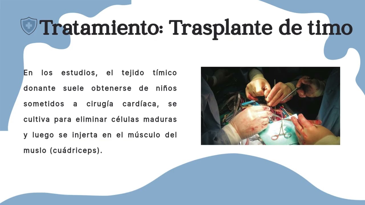 ENFERMEDAD DE DIGEORGE